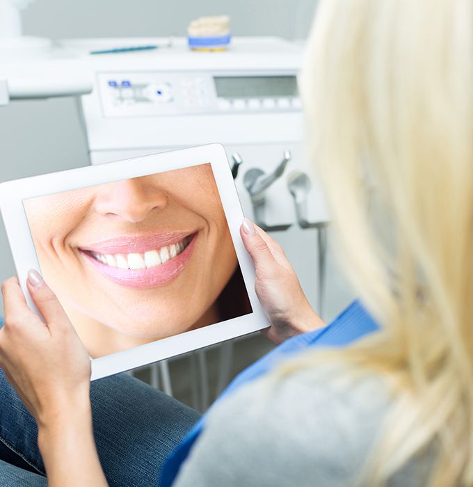 Woman looking at her virtual smile design