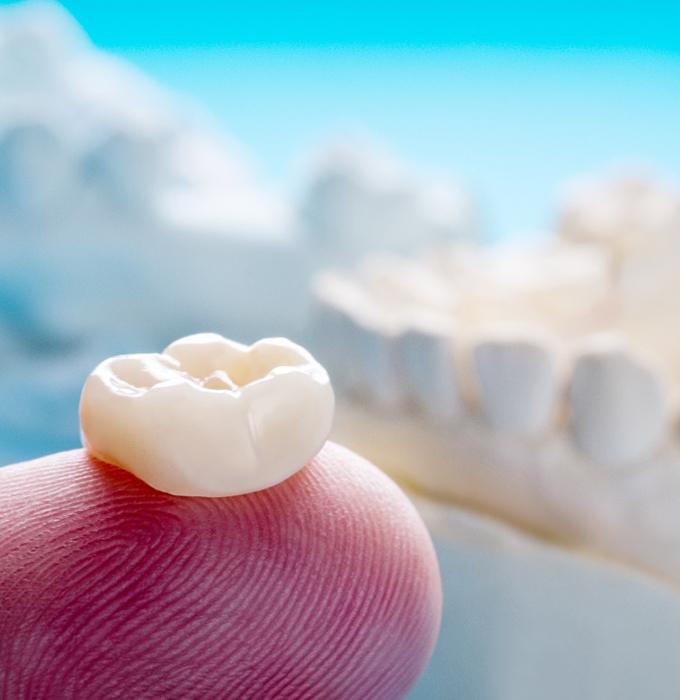 A close-up of a dental crown sitting on a finger