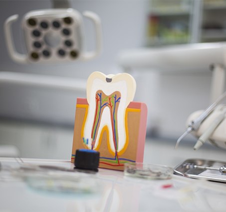 Model of the inside of a tooth in need of root canal therapy