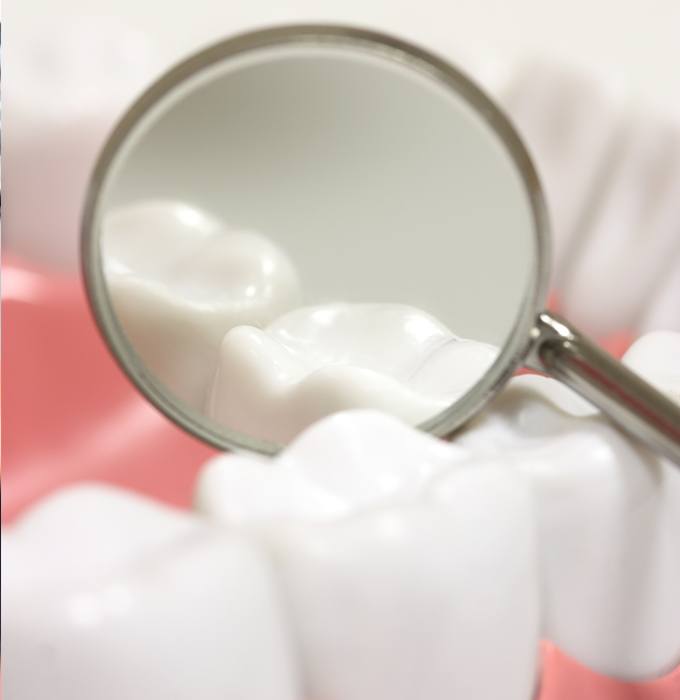 Closeup of smile with dental sealants