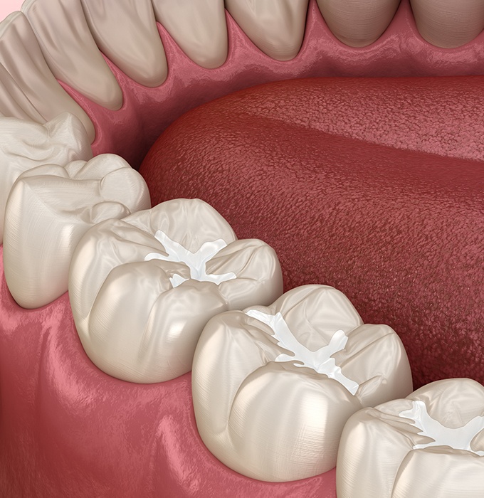 Animated smile with metal free dental restorations