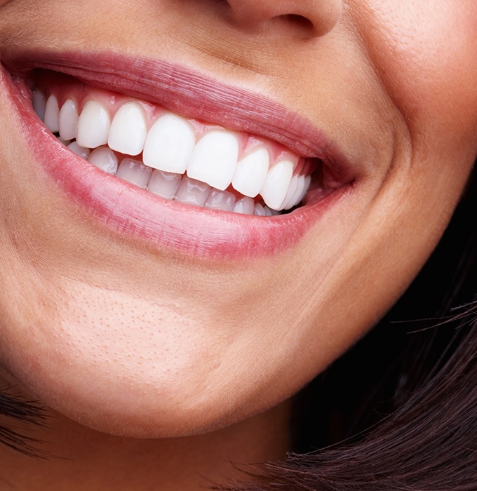 Closeup of smile after teeth whitening