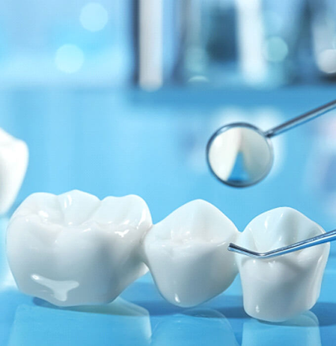 Dental bridge on a table