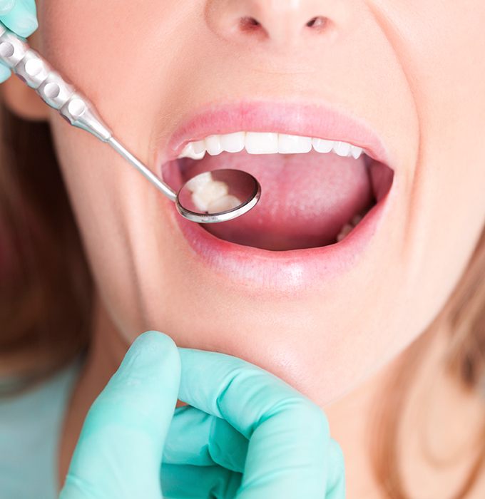 Patient receiving preventive dental exam