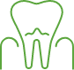 Large animated tooth and gum tissue